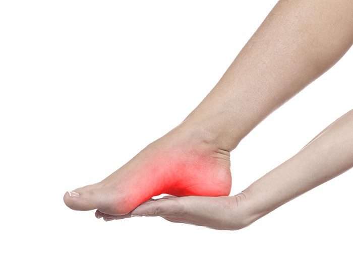 Plantar Fasciitis