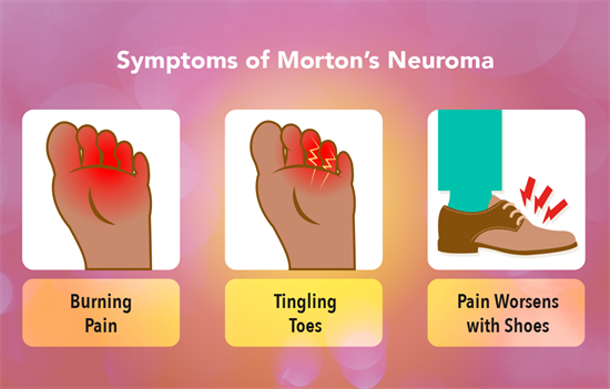 Morton's Neuroma