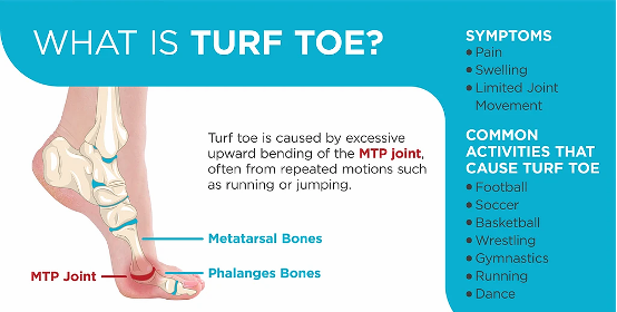 Turf Toe