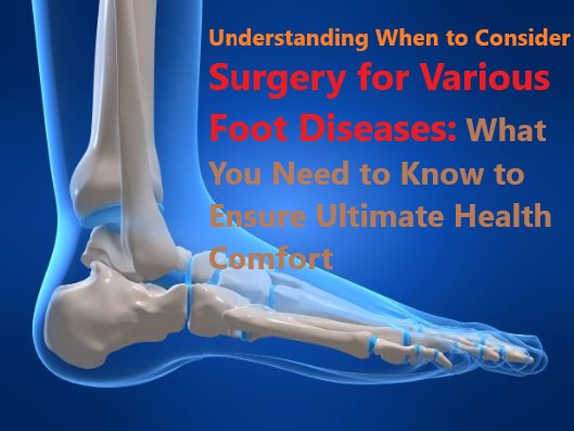 Understanding When to Consider Surgery for Various Foot Diseases: What You Need to Know to Ensure Ultimate Health Comfort